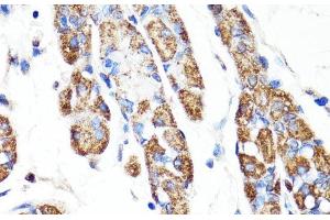 Immunohistochemistry of paraffin-embedded Human stomach using RNF149 Polyclonal Antibody at dilution of 1:100 (40x lens). (RNF149 抗体)