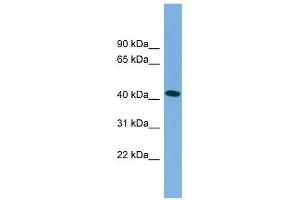 MAPT antibody used at 1 ug/ml to detect target protein. (MAPT 抗体  (Middle Region))