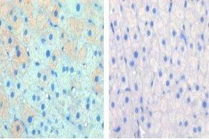 IHC data of FFPE cow lactation tissue tested with CPT1A antibody (left) and without primary Ab (right). (CPT1A 抗体  (AA 606-636))