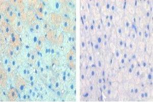IHC data of FFPE cow lactation tissue tested with CPT1A antibody (left) and without primary Ab (right).