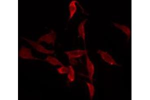 ABIN6277268 staining 293 by IF/ICC. (PAK1 抗体  (N-Term))