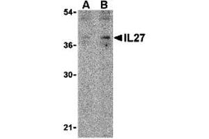 Western Blotting (WB) image for anti-Interleukin 27 (IL27) (N-Term) antibody (ABIN1031413)