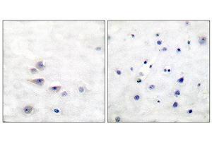 Immunohistochemistry (IHC) image for anti-SHC (Src Homology 2 Domain Containing) Transforming Protein 1 (SHC1) (pTyr427) antibody (ABIN1847217) (SHC1 抗体  (pTyr427))
