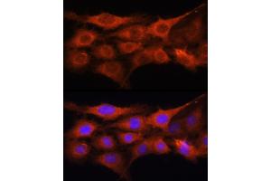 Immunofluorescence analysis of C6 cells using GALNS Rabbit pAb (ABIN6131691, ABIN6140937, ABIN6140938 and ABIN6221120) at dilution of 1:100 (40x lens). (GALNS 抗体  (AA 353-522))