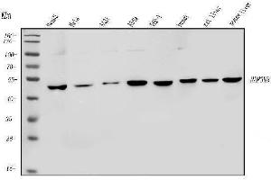 Western blot analysis of MAP3K8 using anti-MAP3K8 antibody (ABIN4886663). (MAP3K8 抗体  (AA 9-193))