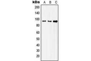 Western blot analysis of Insulin Receptor expression in HeLa (A), SKOV3 (B), HepG2 (C) whole cell lysates. (Insulin Receptor 抗体  (C-Term))