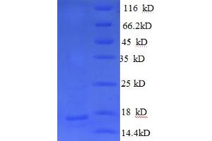 SDS-PAGE (SDS) image for Neurofascin (NFASC) (AA 1239-1347) protein (His tag) (ABIN5710005)
