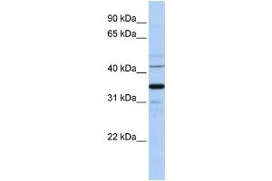 WB Suggested Anti-WNT5A Antibody Titration:  1 ug/ml  Positive Control:  Hela cell lysate WNT5A is strongly supported by BioGPS gene expression data to be expressed in Human HeLa cells (WNT5A 抗体  (Middle Region))