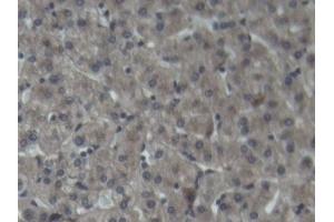 Detection of C3 in Porcine Liver Tissue using Polyclonal Antibody to Complement Component 3 (C3) (C3 抗体  (AA 23-300))