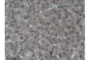 Detection of C3 in Porcine Liver Tissue using Polyclonal Antibody to Complement Component 3 (C3) (C3 抗体  (AA 23-300))