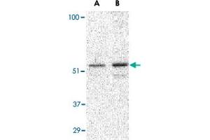 Western blot analysis of PLIN3 in Daudi cell lysate with PLIN3 polyclonal antibody  at (A) 0. (PLIN3 抗体  (C-Term))