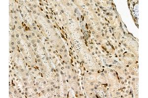 Phospho-FAK (Tyr925) Antibody at 1/100 staining Mouse kidney tissue by IHC-P.