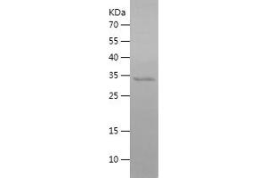 Western Blotting (WB) image for Hepcidin Antimicrobial Peptide (HAMP) (AA 24-84) protein (His-IF2DI Tag) (ABIN7123312) (Hepcidin Protein (AA 24-84) (His-IF2DI Tag))
