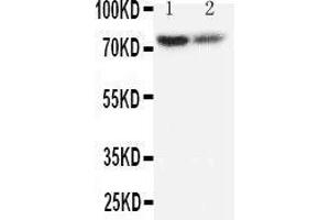 Anti-PMP70 antibody, Western blotting Lane 1: Rat Lung Tissue Lysate Lane 2: Rat Ovary Tissue Lysate (CX3CL1 抗体  (C-Term))