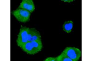 Immunofluorescence analysis of HeLa cells using MAPK14 antibody (ABIN4904640).