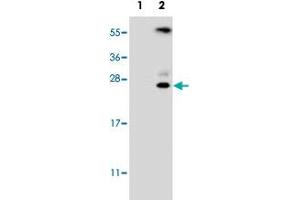 Western blot analysis of KLK6 (arrow) using KLK6 polyclonal antibody .