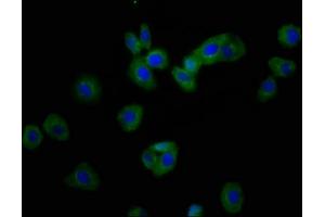 Immunofluorescence staining of HepG2 cells with ABIN7168050 at 1:166, counter-stained with DAPI. (RHOU 抗体  (AA 1-48))