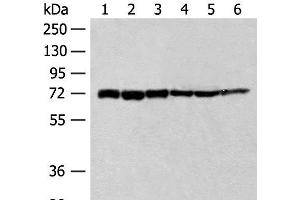 Western blot analysis of 293T cell Human fetal brain tissue Jurkat cell Hela cell Mouse heart tissue lysates using TCF25 Polyclonal Antibody at dilution of 1:250 (TCF25 抗体)
