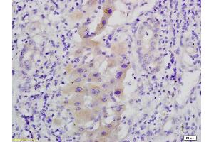 Immunohistochemistry (IHC) image for anti-Mitogen-Activated Protein Kinase Kinase 1 (MAP2K1) (pSer298) antibody (ABIN733703)