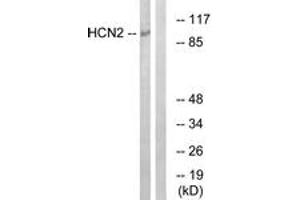 Western blot analysis of extracts from Jurkat cells, using HCN2 Antibody. (HCN2 抗体  (AA 491-540))