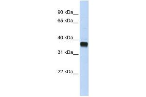 Western Blotting (WB) image for anti-Nudix (Nucleoside Diphosphate Linked Moiety X)-Type Motif 18 (NUDT18) antibody (ABIN2459244) (NUDT18 抗体)