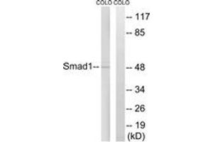 Western blot analysis of extracts from COLO cells, treated with EGF 200ng/ml 30', using Smad1 (Ab-465) Antibody. (SMAD1 抗体  (AA 416-465))