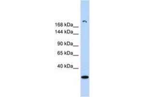 Image no. 1 for anti-Ubiquitously Transcribed Tetratricopeptide Repeat Gene, Y-Linked (UTY) (AA 971-1020) antibody (ABIN6742129) (UTY 抗体  (AA 971-1020))