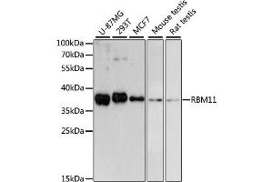Western blot analysis of extracts of various cell lines, using RBM11 antibody (ABIN6133082, ABIN6146756, ABIN6146757 and ABIN6217133) at 1:3000 dilution. (RBM11 抗体  (AA 1-281))