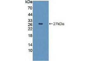 Western blot analysis of recombinant Human INSRR. (INSRR 抗体  (AA 1090-1295))