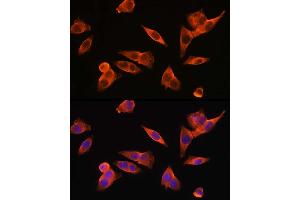 Immunofluorescence analysis of HepG2 cells using TLR4 Rabbit pAb (ABIN6134488, ABIN6149222, ABIN6149225 and ABIN6215119) at dilution of 1:150 (40x lens). (TLR4 抗体  (AA 500-600))