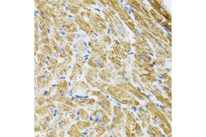 Immunohistochemistry of paraffin-embedded rat heart using POLG2 antibody (ABIN6132502, ABIN6145894, ABIN6145895 and ABIN6222405) at dilution of 1:100 (40x lens).