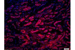 Formalin-fixed and paraffin-embedded human kidney labeled with Anti-phospho-MLC(Ser20) /Myosin light chain(Ser20) Polyclonal Antibody, Unconjugated (ABIN872283) 1:200, overnight at 4°C, The secondary antibody was Goat Anti-Rabbit IgG, Cy3 conjugated used at 1:200 dilution for 40 minutes at 37°C. (MYL9 抗体  (pSer20))