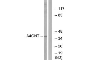 Western blot analysis of extracts from K562 cells, using A4GNT antibody. (A4GNT 抗体  (Internal Region))