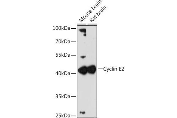 Cyclin E2 anticorps  (C-Term)