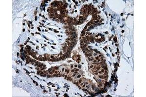 Immunohistochemical staining of paraffin-embedded breast tissue using anti-TPMT mouse monoclonal antibody. (TPMT 抗体)