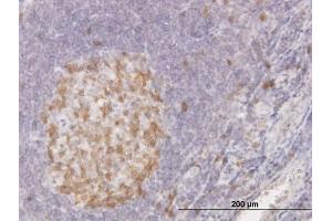 Immunoperoxidase of monoclonal antibody to CDC2 on formalin-fixed paraffin-embedded human tonsil. (CDK1 抗体  (AA 211-297))