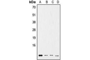 Western blot analysis of Ub expression in HeLa (A), NIH3T3 (B), rat kidney (C), HL60 (D) whole cell lysates. (Ubiquitin 抗体  (Center))