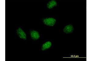 Immunofluorescence of purified MaxPab antibody to RIP on HeLa cell. (RPAIN 抗体  (AA 1-219))