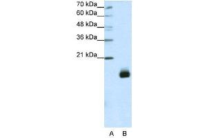 WB Suggested Anti-RPS14  Antibody Titration: 1.
