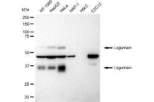 anti-Legumain (LGMN) antibody