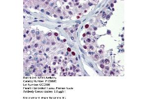 Immunohistochemistry with Human Testis lysate tissue (NFX1 抗体  (Middle Region))