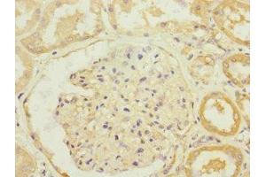 Immunohistochemistry of paraffin-embedded human kidney tissue using ABIN7170096 at dilution of 1:100 (SLC13A2 抗体  (AA 345-455))