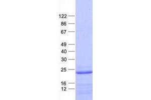Western Blotting (WB) image for Aspartate Dehydrogenase Domain Containing (ASPDH) protein (His tag) (ABIN2714997)