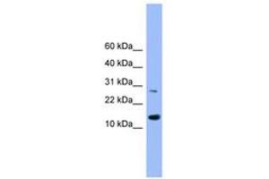 Image no. 1 for anti-Glutaredoxin 2 (GRX2) (AA 91-141) antibody (ABIN6745473) (Glutaredoxin 2 抗体  (AA 91-141))