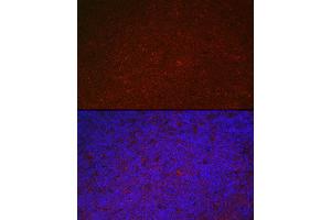 Immunofluorescence (IF) image for anti-Leukocyte Immunoglobulin-Like Receptor, Subfamily B (With TM and ITIM Domains), Member 4 (LILRB4) (AA 22-259) antibody (ABIN6143221)