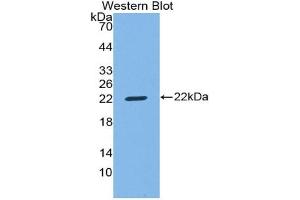 Western blot analysis of the recombinant protein. (CD8B 抗体  (AA 22-175))