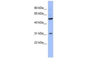RBMS3 antibody used at 1 ug/ml to detect target protein. (RBMS3 抗体  (Middle Region))