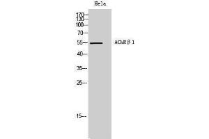 Western Blotting (WB) image for anti-AChR beta 1 (N-Term) antibody (ABIN3173651) (AChR beta 1 (N-Term) 抗体)