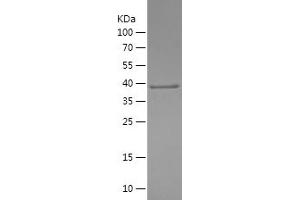 Western Blotting (WB) image for Phosphatidylinositol 4-Kinase, Catalytic, beta (PI4KB) (AA 1-128) protein (His-IF2DI Tag) (ABIN7124401)