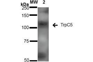 Western Blot analysis of Rat Brain Membrane showing detection of ~110 kDa TrpC5 protein using Mouse Anti-TrpC5 Monoclonal Antibody, Clone S67-15 . (TRPC5 抗体  (AA 827-845) (Biotin))